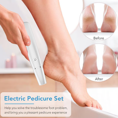 💥Portable Electric Feet Callus Remover