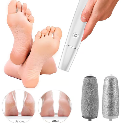 💥Portable Electric Feet Callus Remover