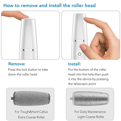 💥Portable Electric Feet Callus Remover
