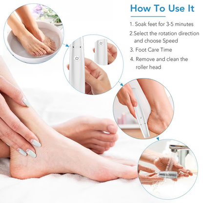 💥Portable Electric Feet Callus Remover