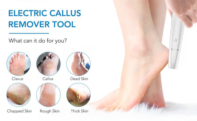 💥Portable Electric Feet Callus Remover