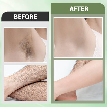 🌸LAST DAY PROMOTION SALE 49% OFF🌸Hair Removal Cream Set for Full Body