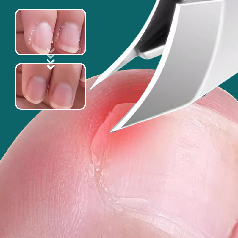 Anti-Splash 25° Slant Edge Nail Clipper 3-Piece Set – Precise Cut, Comfortable Grip & Safe Splash Guard
