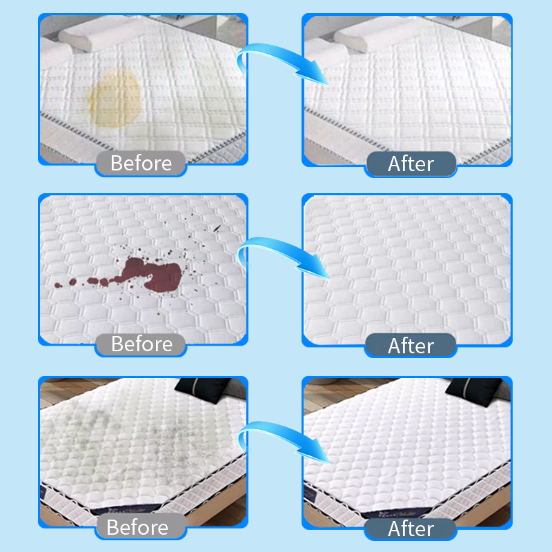 🧴Mattress Yellow Stain Cleaner