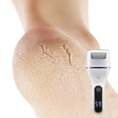 Portable Electric Foot Callus Remover - Quick & Efficient Dead Skin Removal