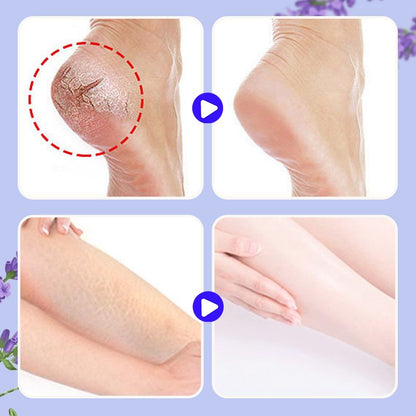 Anti-Crack Nourishing Foot Repair Balm