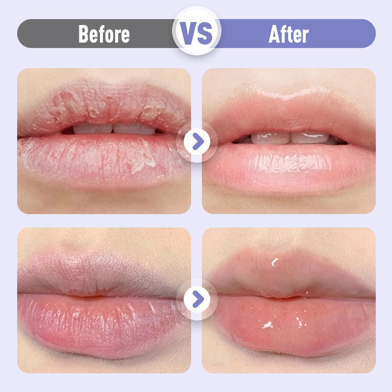 👑Plumping & Anti-Wrinkle Hydrating Lip Serum👑