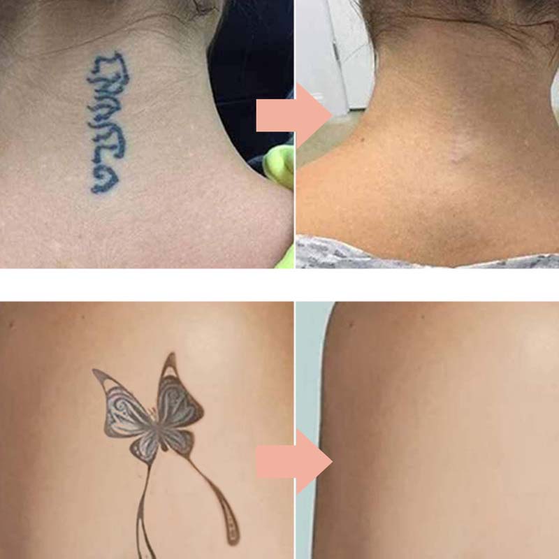 🎁Gentle Effective Multi-Use Tattoo Fading Cream