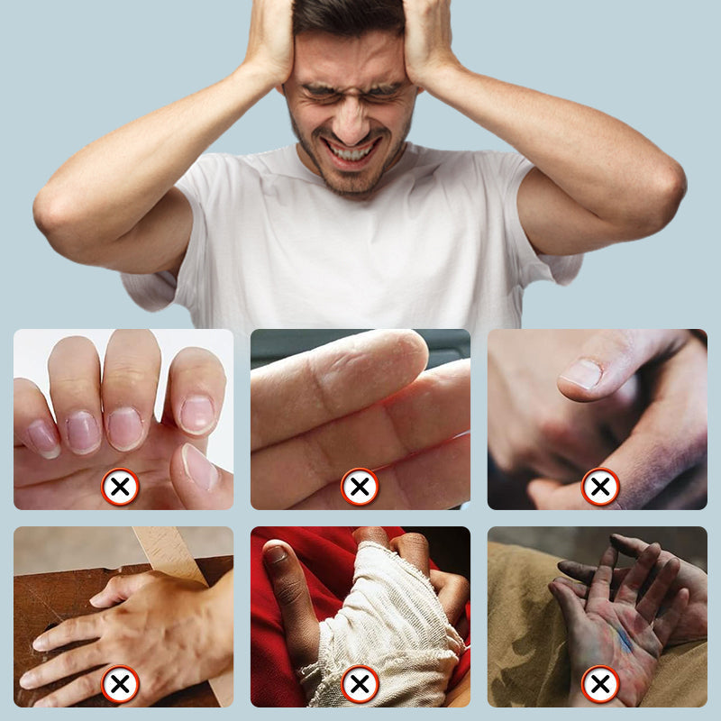 Non-Slip Disposable Textured Finger Cots（50% OFF）