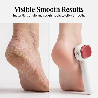 Double-Sided Foot Scraper for Callus Removal