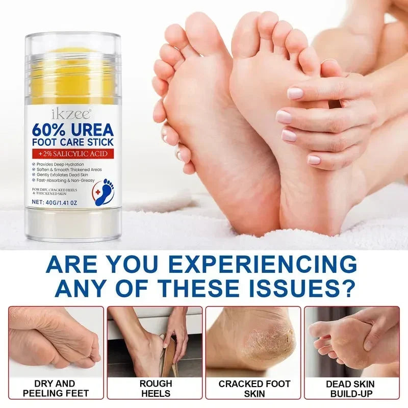🎉Urea Foot Care Stick, Intensive Moisturizing Balm for Dry Cracked Heels & Dead Skin