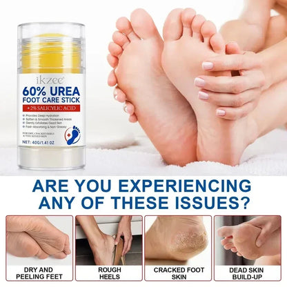 🎉Urea Foot Care Stick, Intensive Moisturizing Balm for Dry Cracked Heels & Dead Skin