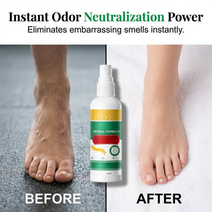 🥳HOT SALE🥳💞10K+ SOLD! Foot Care Spray – Herbal formula, removes calluses & neutralizes odor. Fresh feet – grab yours! ✅
