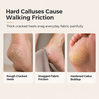 Electric Foot Callus Remover Pedicure Tool for Dead Skin and Callus Removal Automatic Foot Grinder for Smooth Heels