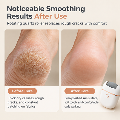 Electric Foot Callus Remover Pedicure Tool for Dead Skin and Callus Removal Automatic Foot Grinder for Smooth Heels