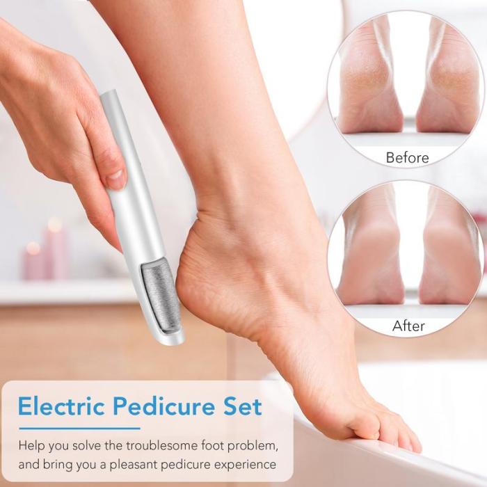 💥Portable Electric Feet Callus Remover